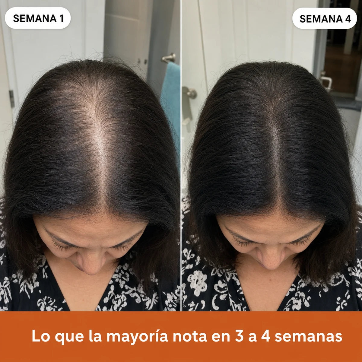 Cabello más denso en la raya con el paso de las semanas