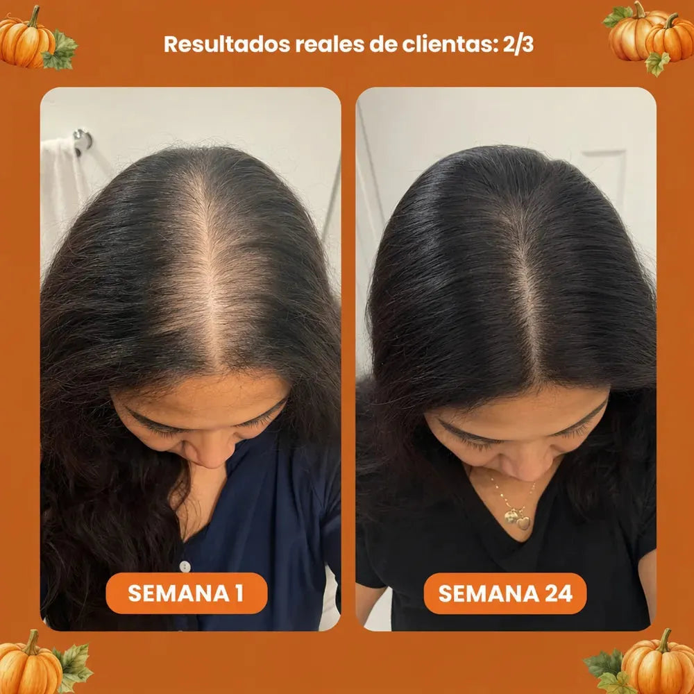 Aceite de Semilla de Calabaza — Softgels 3.000 mg — imagen 5