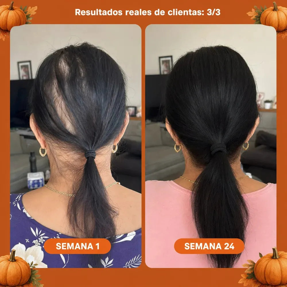 Aceite de Semilla de Calabaza — Softgels 3.000 mg — imagen 6