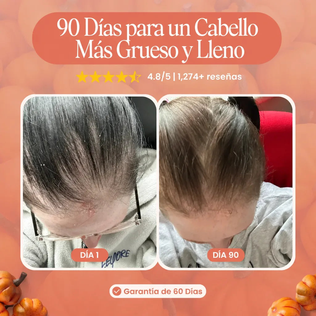 Aceite de Semilla de Calabaza con Saw Palmetto — Fórmula Capilar 3,000 mg