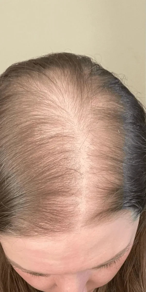 Foto de Anónima