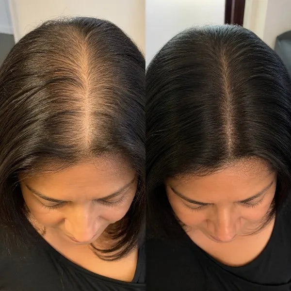 Resultado — Raquel T.