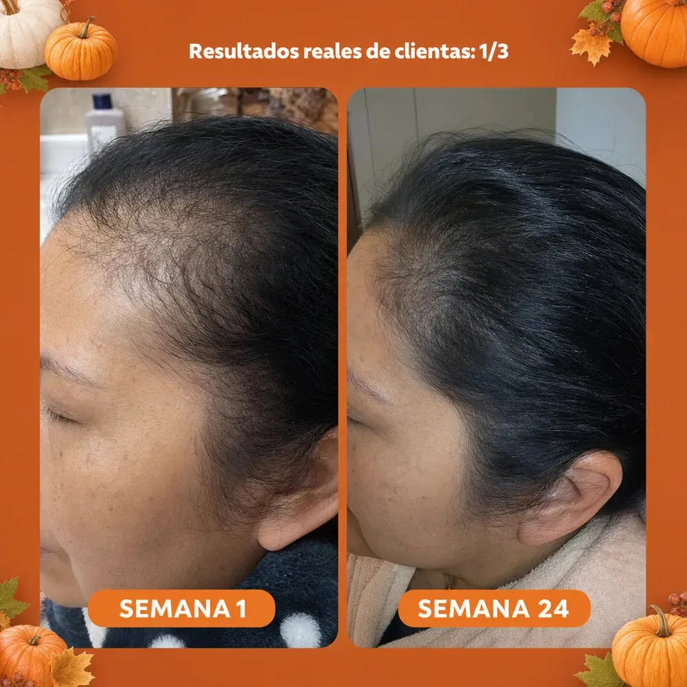 Aceite de Semilla de Calabaza — Softgels 3.000 mg — imagen 4